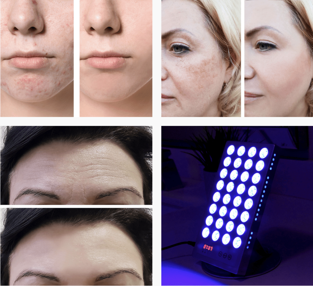 Nuglow Rgb Light Therapya